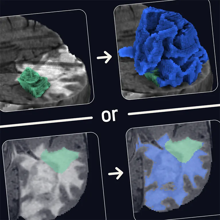 Interactive Volumetric Region Growing for Brain Tumor Segmentation on MRI using WebGL