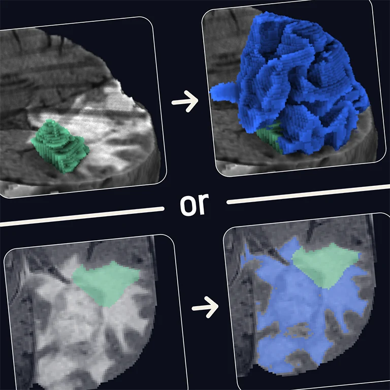 Thumbnail of Interactive Volumetric Region Growing for Brain Tumor Segmentation on MRI using WebGL